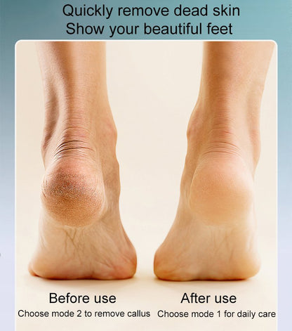 Rechargeable electric foot callus remover